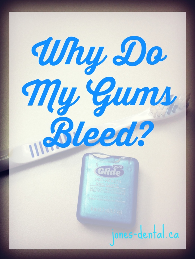 Why Do My Gums Bleed - jones-dental.ca